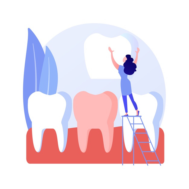dental-veneers-abstract-concept-vector-illustration-veneer-placement-dental-beauty-solution-teeth-aesthetics-cosmetic-dentistry-service-orthodontic-clinic-celebrity-smile-